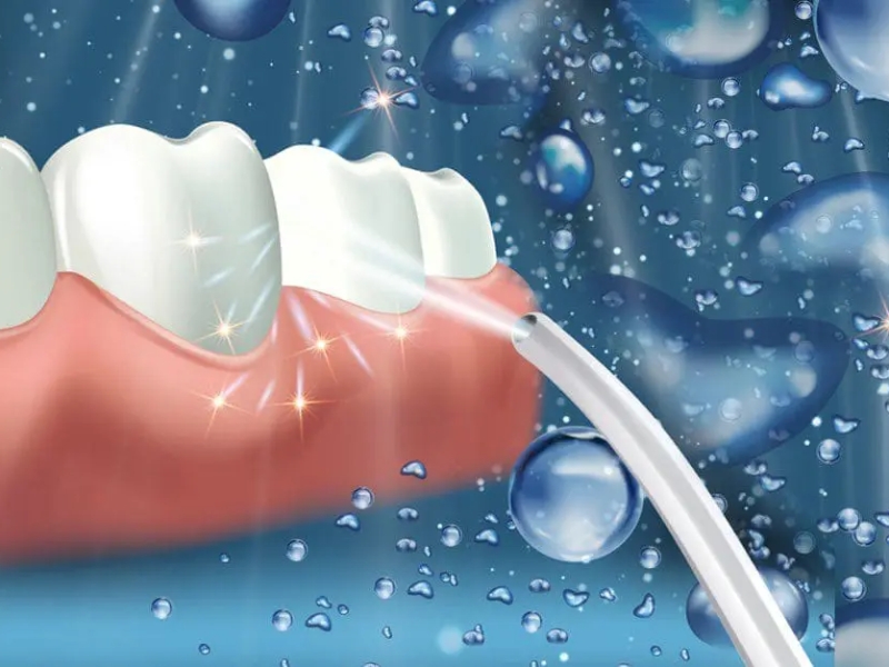 “Bọc răng sứ có nên dùng máy tăm nước không?” là thắc mắc phổ biến của nhiều người