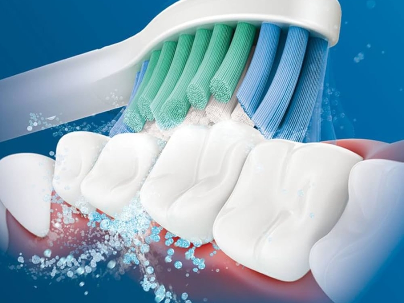 Công nghệ của bàn chải điện là yếu tố quyết định hiệu quả làm sạch và sự thoải mái khi sử dụng