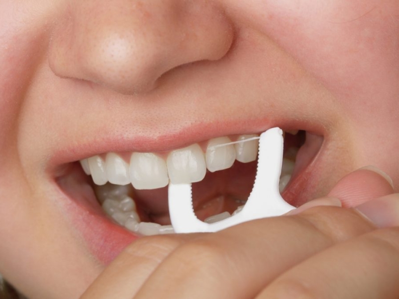  Tăm chỉ nha khoa là công cụ tiện lợi giúp làm sạch răng nhanh chóng