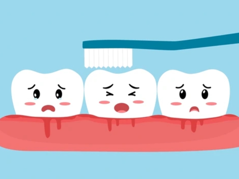 Tình trạng chảy máu khi đánh răng là hiện tượng nướu bị tổn thương