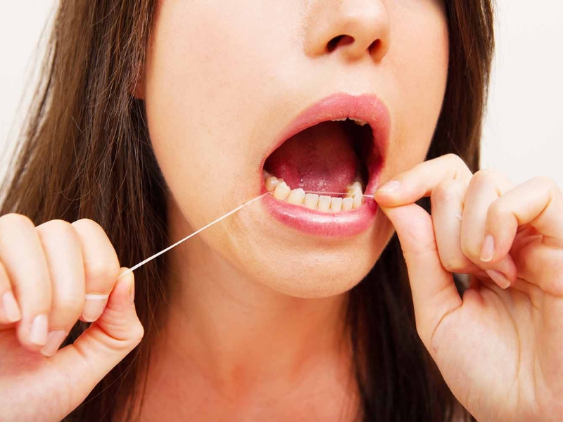 Ưu điểm lớn nhất của chỉ nha khoa là sự tiện dụng, chi phí thấp