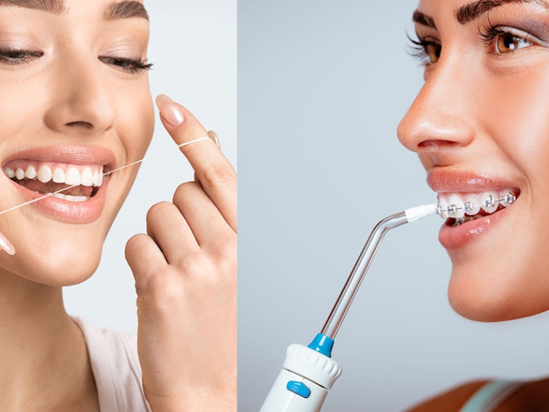 Máy tăm nước và chỉ nha khoa, nên chọn gì?